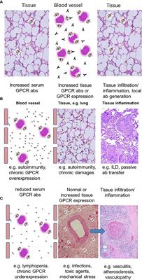 What Makes Antibodies Against G Protein-Coupled Receptors so Special? A Novel Concept to Understand Chronic Diseases